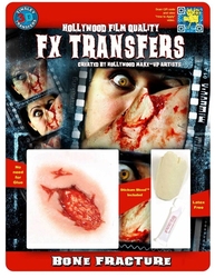 3D FX TRANSFERS -  BONE FRACTURE